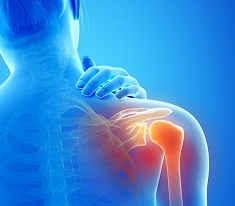 Picture of shoulder in pain